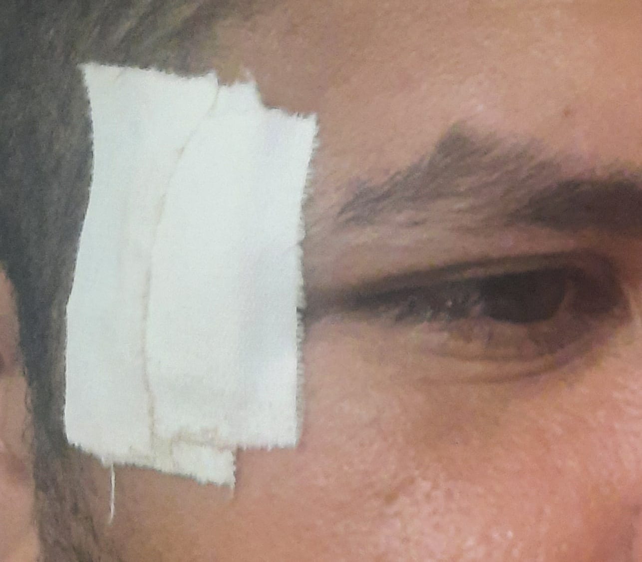Técnico em enfermagem foi agredido quando tentava atender um paciente na UPA do Jardim do Sol
