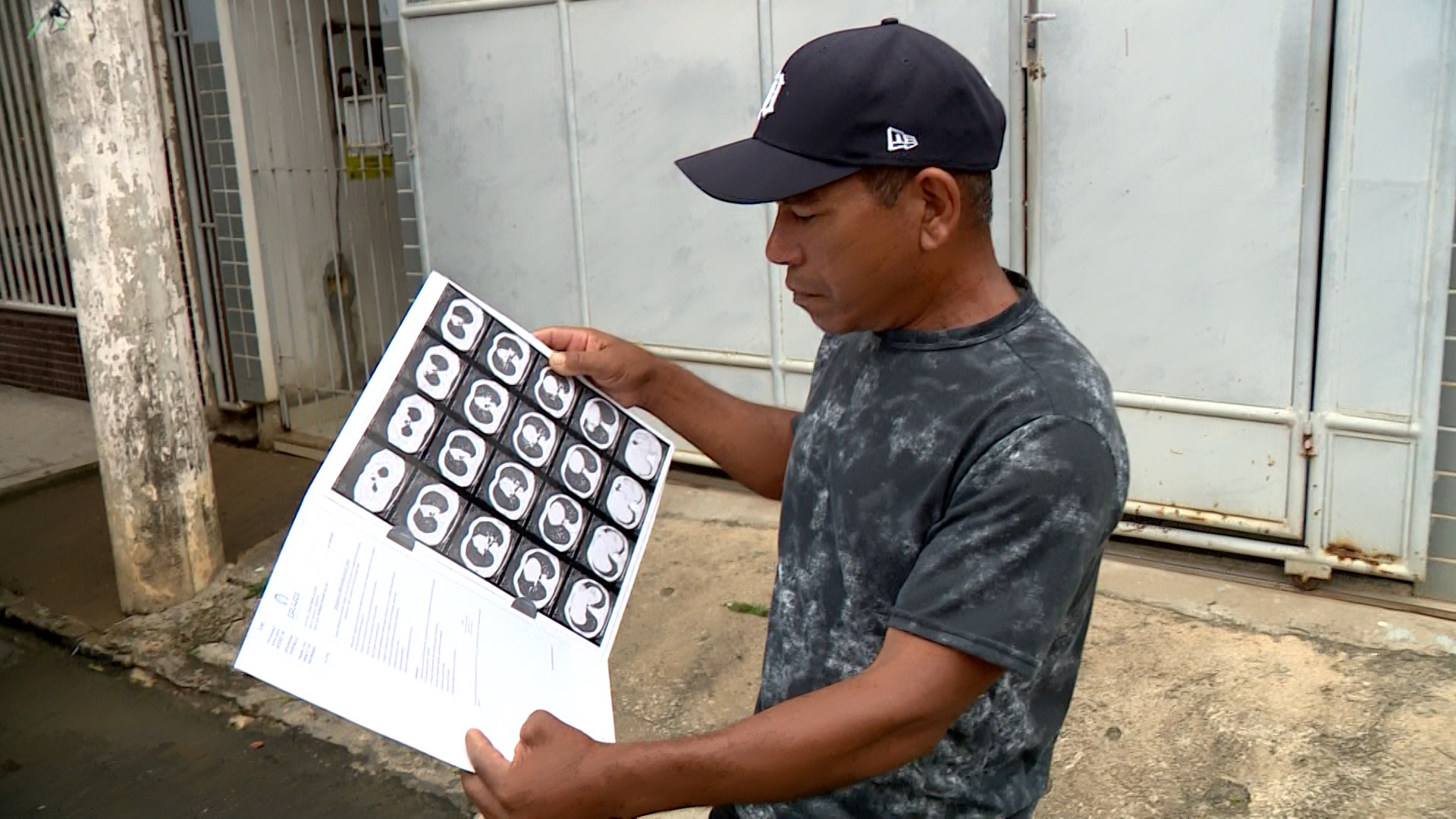 Silicose: doença provocada por pó de rochas atinge trabalhadores no ES