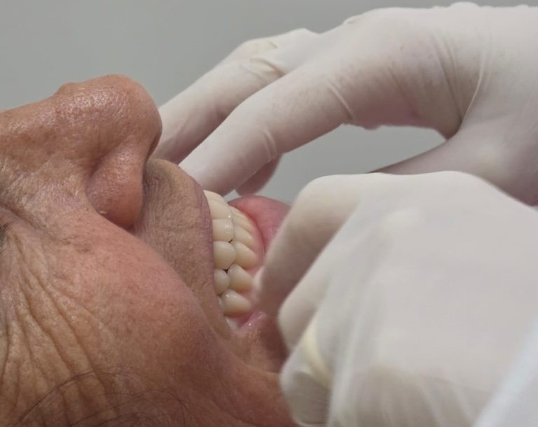 Paciente é submetido a implante dentário em Nova Venécia