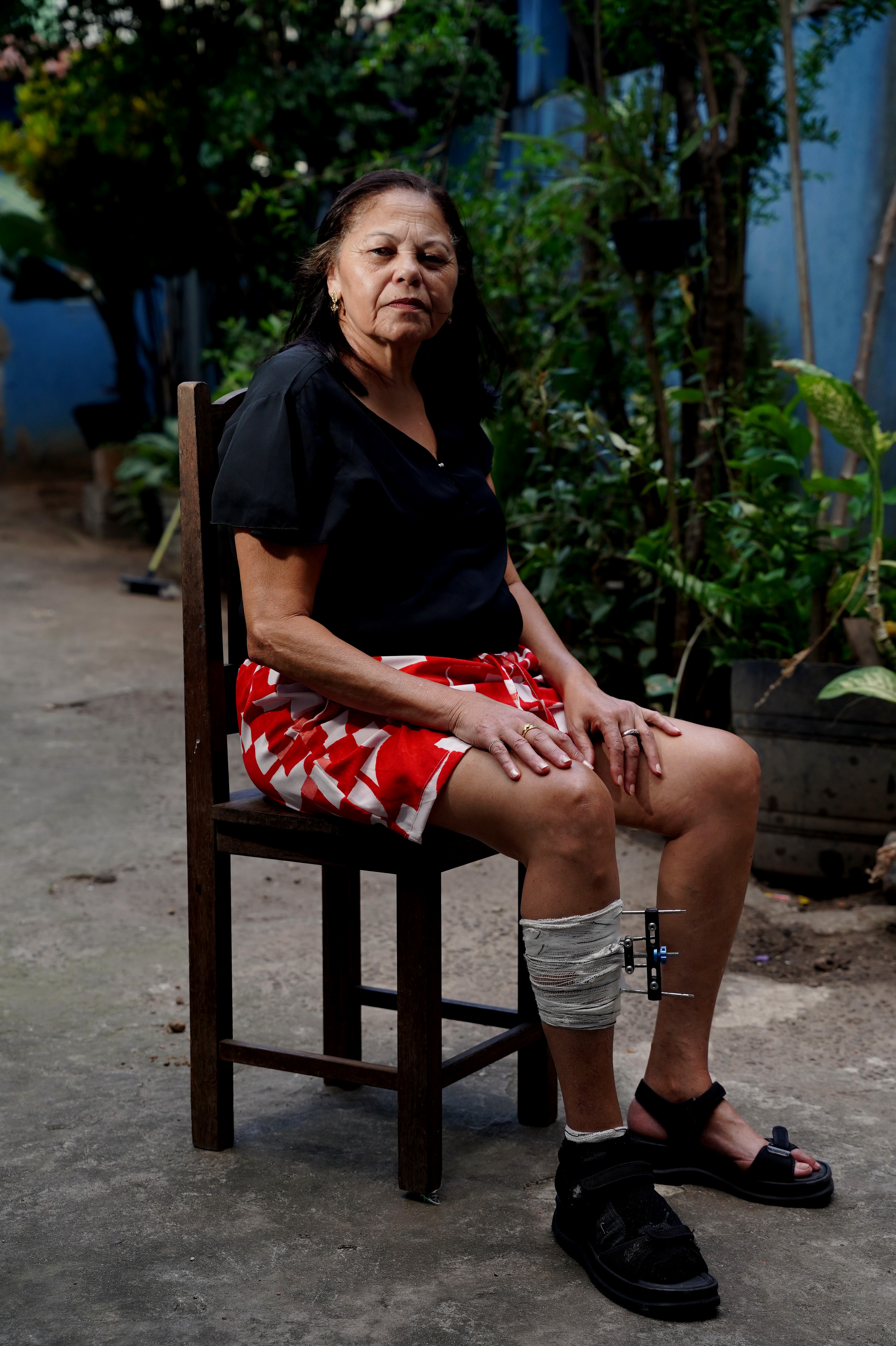 Sonia Mara dos Santos, ela participou do tratamento e evitou amputar membros inferiores