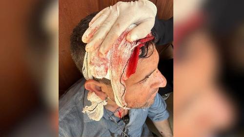 Polícia Federal, agente do GSI, ficou ferido após ser agredido com uma casaca na cabeça em visita do Lula a Aracruz